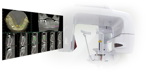 安全・安心の「歯科用CT撮影装置」を完備