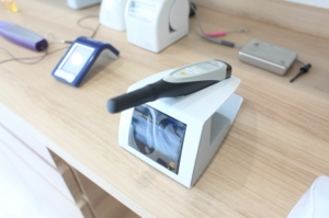 虫歯検出装置・ダイアグノデント